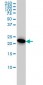 AK1 Antibody (monoclonal) (M06)
